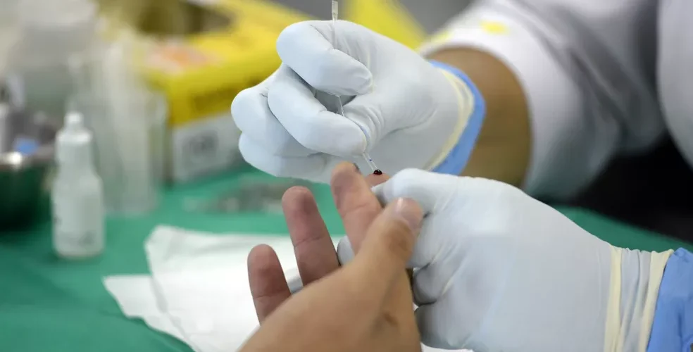 Julho Amarelo: Alerta para o perigo das hepatites virais