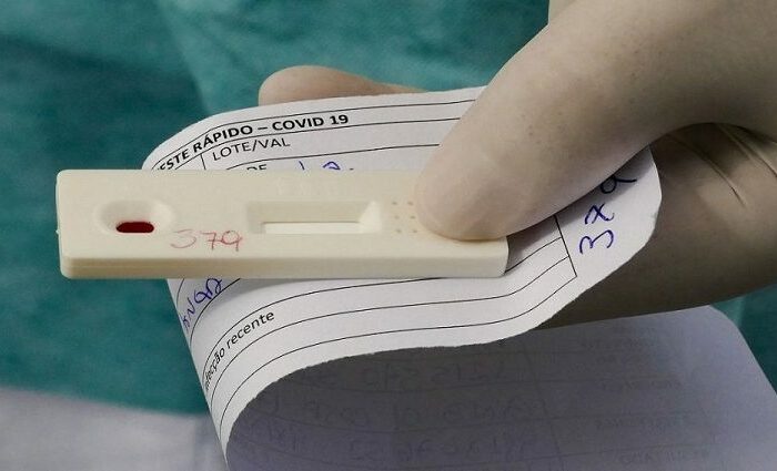 MS tem 137 novos casos de covid e duas mortes registradas na última semana