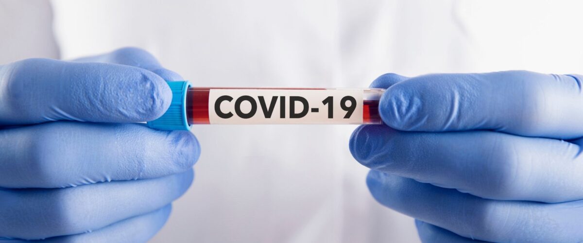 Com 34 registros, MS teve duas mortes por covid na última semana