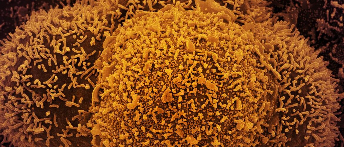 Nova subvariante da covid-19 é identificada em Mato Grosso