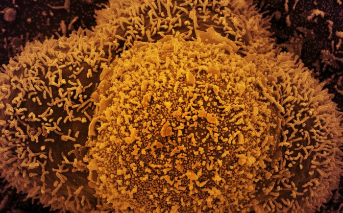 Nova subvariante da covid-19 é identificada em Mato Grosso