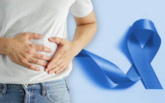 SES apoia campanha Março Azul, em alusão à prevenção e diagnóstico precoce do câncer de intestino