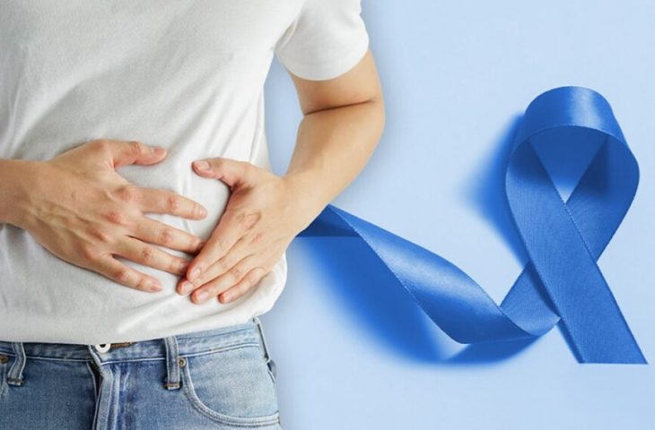SES apoia campanha Março Azul, em alusão à prevenção e diagnóstico precoce do câncer de intestino