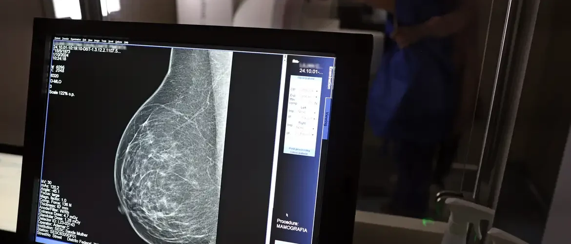 Médicos reafirmam eficácia da mamografia para prevenir câncer de mama