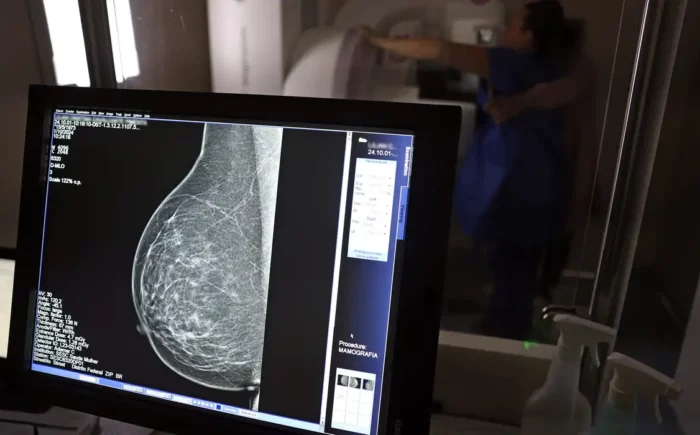Médicos reafirmam eficácia da mamografia para prevenir câncer de mama