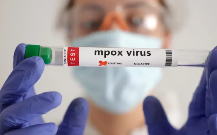 OMS convoca comitê para reavaliar emergência global por mpox